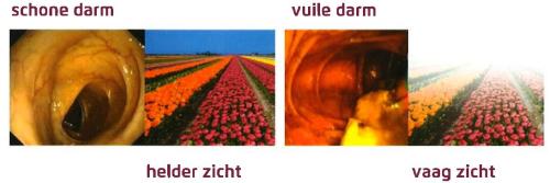 Pleinvue-schone-vuile-darm.jpg