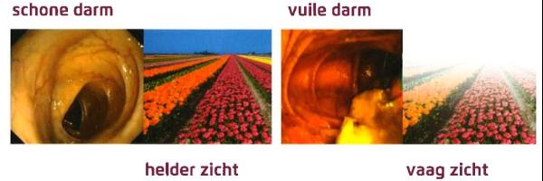 Pleinvue-schone-vuile-darm.jpg
